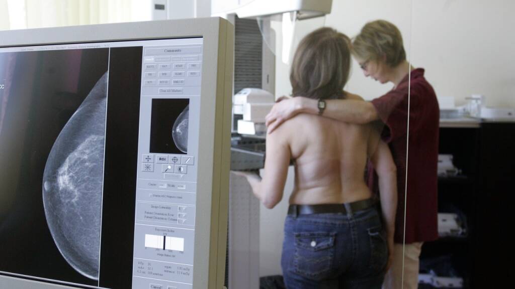 Alle Aargauerinnen von 50 bis 69 Jahren sollen künftig kostenlose Vorsorgeuntersuchungen zur Früherkennung von Brustkrebs erhalten. (Archivbild)
