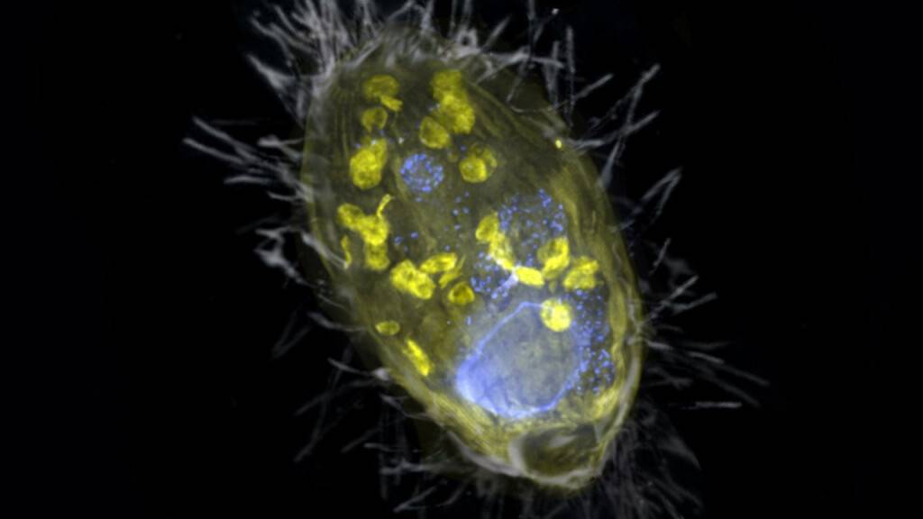 Eine Illustration des Wimperntierchens mit seinem Endosymbionten namens Candidatus Azoamicus ciliaticola. Der einzellige Wirt verleibte sich seinen Mitbewohner vor 200 bis 300 Millionen Jahren ein. Dank ihm überlebt er nun in sauerstofffreier Umgebung. (Pressebild)