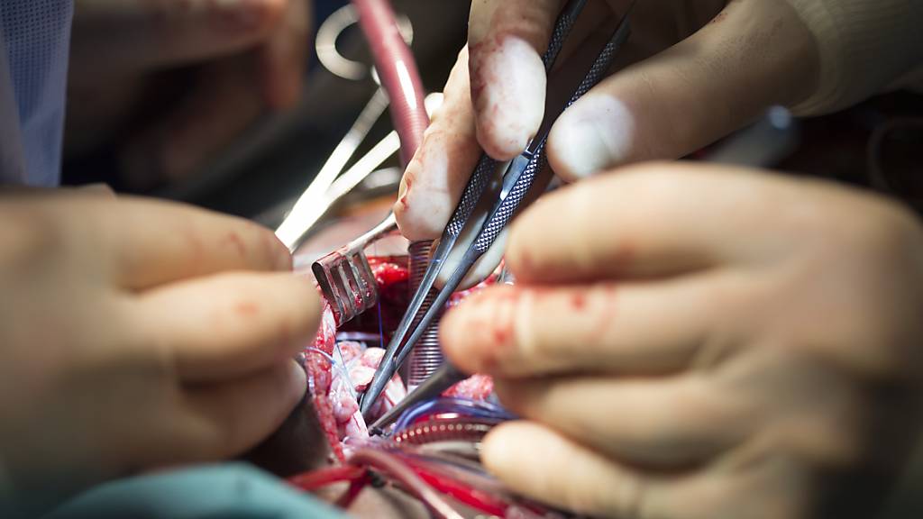 Der Direktor der Herzchirurgie am Unispital Zürich verwendete Implantate von Firmen, an denen er selber beteiligt war. Das Unispital verstärkt nun die Kontrolle. (Symbolbild)