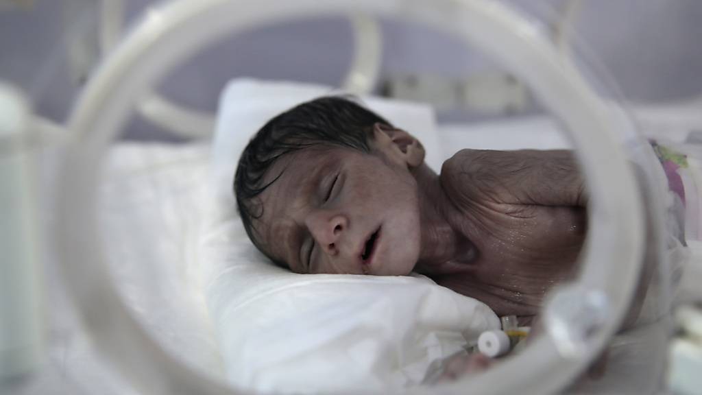 ARCHIV - Ein unterernährtes Neugeborenes liegt in einem Inkubator im internationalen Krankenhaus UniMax. Nach Angaben der Vereinten Nationen stehen im Jemen fast 400 000 Kinder vor dem Hungertod. Rund 20 Millionen Menschen brauchten Hilfe, sagte der UN-Koordinator im Jemen, David Gressly, am Montag in Genf. Foto: Hani Al-Ansi/dpa
