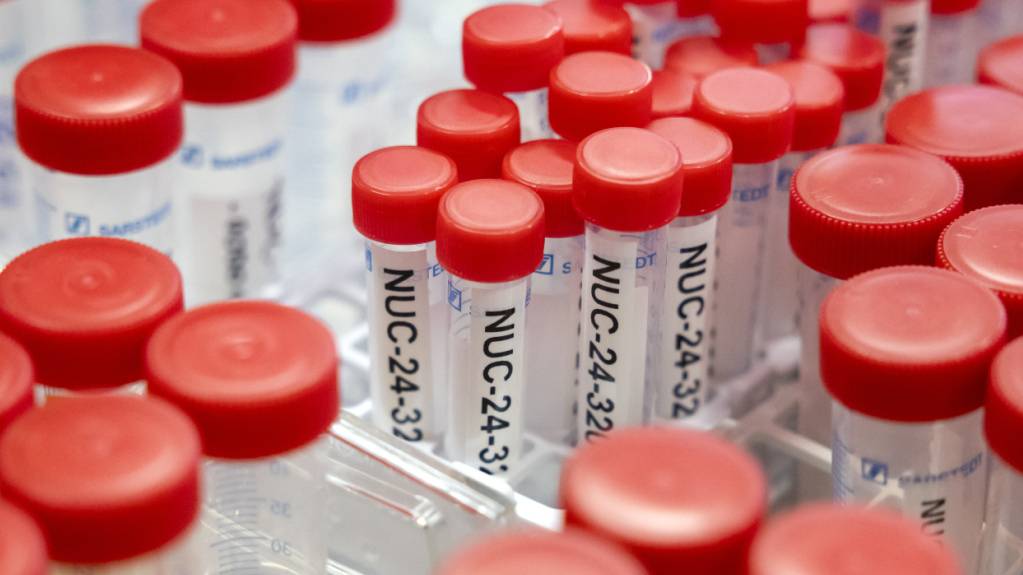 Die Stadt Luzern macht im Gebiet Würzenbach, zwischen der Lidostrasse und der Kreuzbuchstrasse, verschiedene Altlastenuntersuchungen. (Symbolbild)