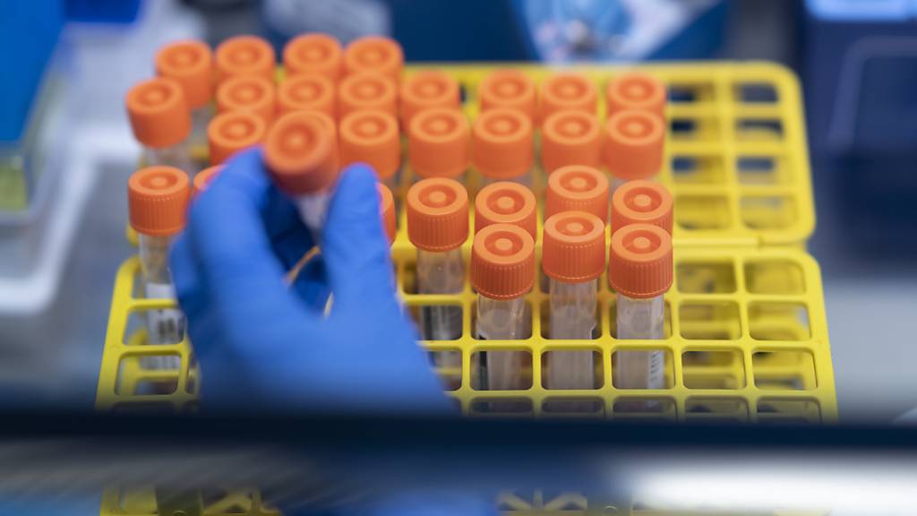 Bisher liessen sich rund 800 Zürcherinnen und Zürcher gratis auf Corona testen. Viele Infizierte dürften sich aber mit einem Selbsttest begnügen. Daher gibt es keine verlässlichen Infektionszahlen. (Symbolbild)