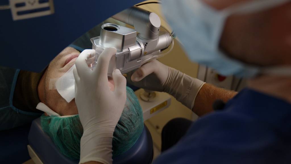Augenlasern