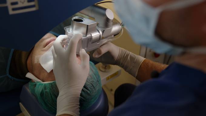 Augenlasern