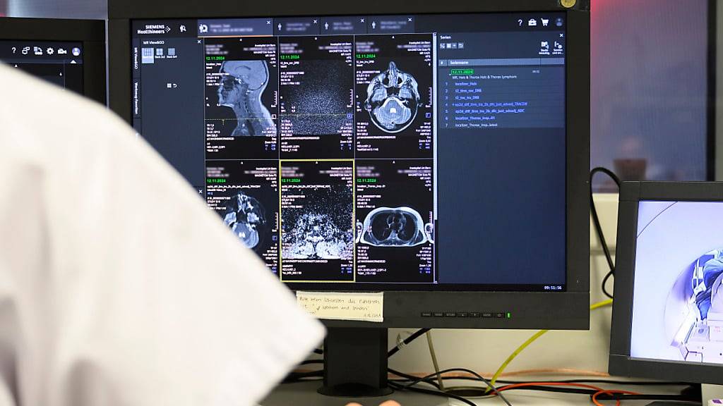 Untersuchung mit einem Magnetresonanztomografen (MRT): Angesichts steigender Kosten empfiehlt die Finanzkontrolle, den Einsatz von bildgebenden Verfahren besser zu kontrollieren. (Themenbild)