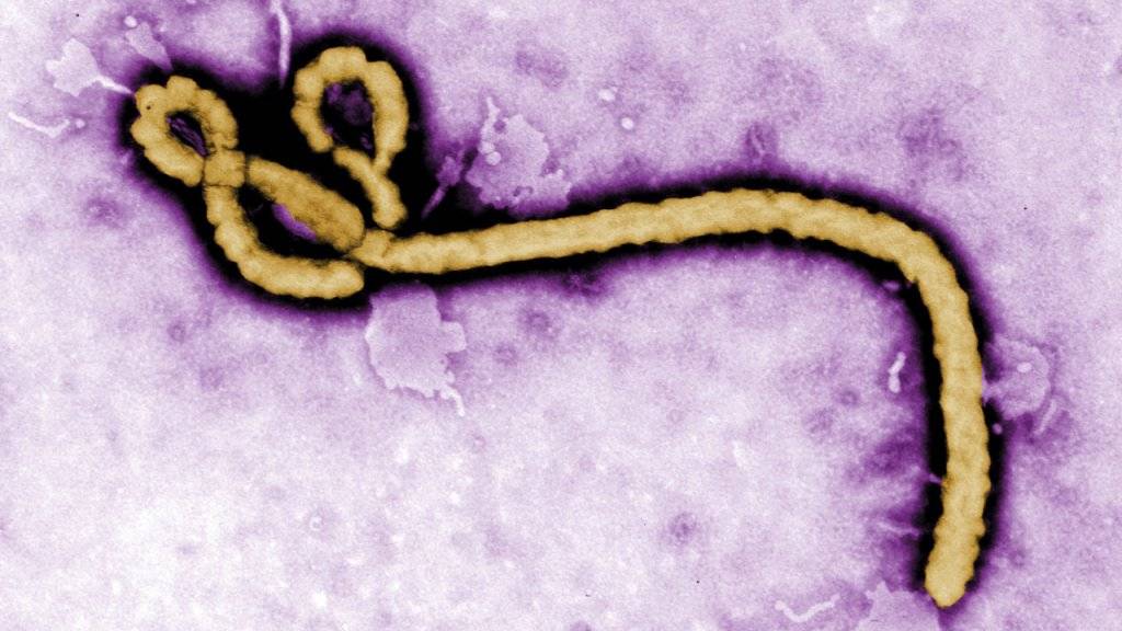 Ein Ebola-Erreger, aufgenommen mit einem Transmissionselektronenmikroskop: Eine Infektion mit diesem Virus endet oft tödlich, bisher gibt es noch kein Heilmittel, eine Impfung ist in der Entwicklung.