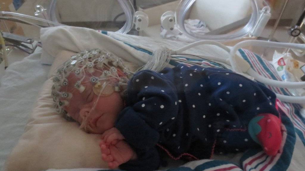 Mit einem weichen EEG-Netz beobachteten Forscher die Antwort des Gehirns von Babys auf einen Luftstoss.