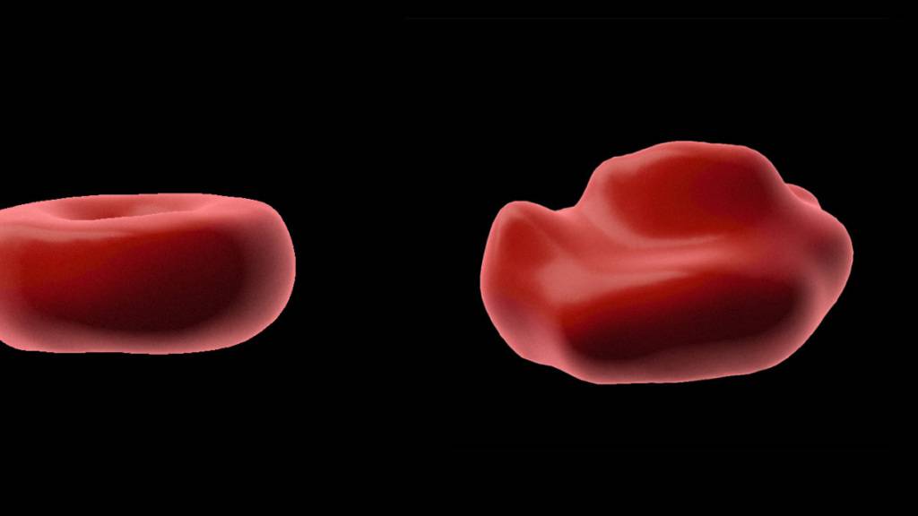 Gesunde Blutzellen haben die Form eines Donuts. Nach Kontakt mit gewissen Medikamenten, oder bei gewissen Krankheiten verformen sich die Zellen.