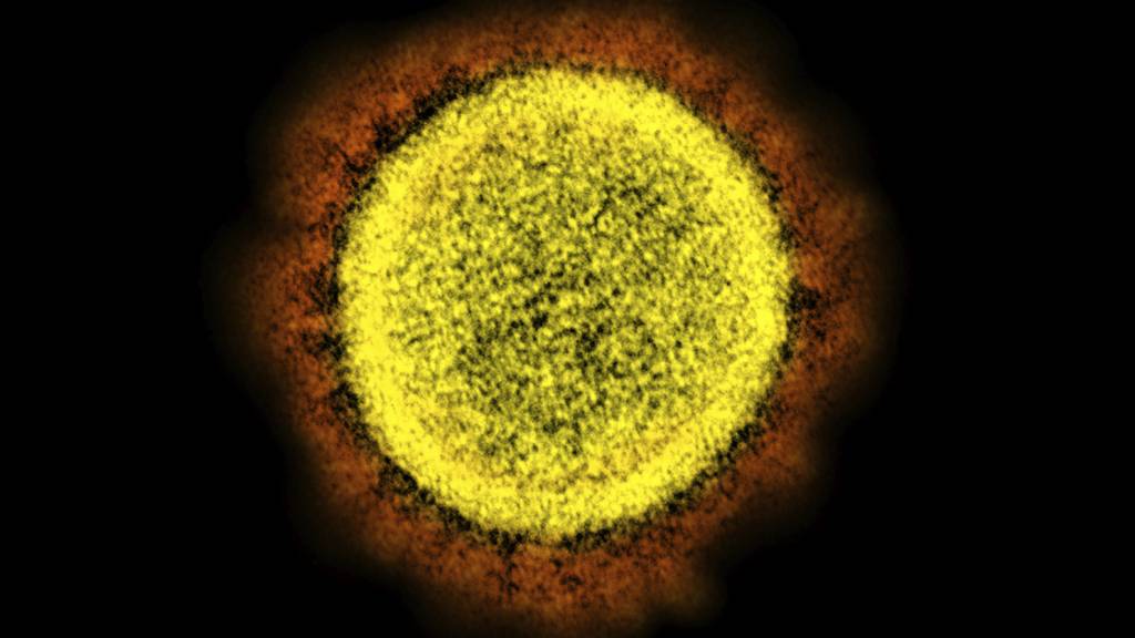 ARCHIV - Eine elektronenmikroskopische Aufnahme zeigt ein von einem Patienten isoliertes Partikel des Coronavirus SARS-CoV-2 in einem Labor. Foto: NIAID/NIH/AP/dpa - ACHTUNG: Nur zur redaktionellen Verwendung und nur mit vollständiger Nennung des vorstehenden Credits