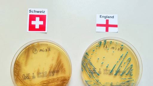 Die Orakel-Bakterien verraten: Für die Schweizer Nati wird es im EM-Viertelfinal eng