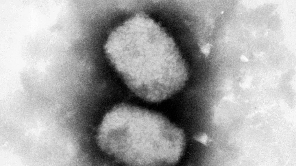 Eine elektronenmikroskopische Aufnahme zeigt das Affenpocken-Virus. (Archivbild)