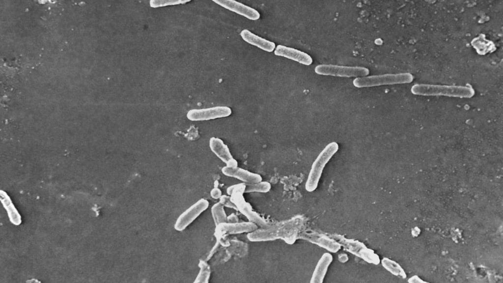 Das Bakterium Pseudomonas aeruginosa braucht ein Gleichgewicht zwischen Ausbreitung und Antibiotikaschutz zum Überleben.