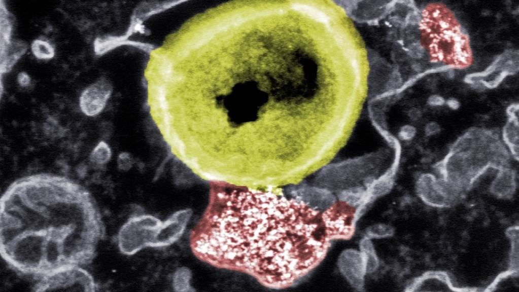 Forschende haben Nanopartikel (rot) entwickelt, die resistente Bakterien (gelb) in Zellkultur abtöten können. (Pressebild)