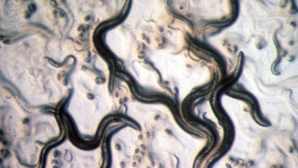 Der Fadenwurm Caenorhabditis elegans sieht bescheiden und ein bisschen eklig aus - aber er versorgt Forscher immer wieder mit Einsichten. Die neueste: Zwei Ribonukleinsäuren genügen, um aus einem ungeordneten Zellhaufen einen wohlgestalteten Embryo zu machen. (Archivbild)
