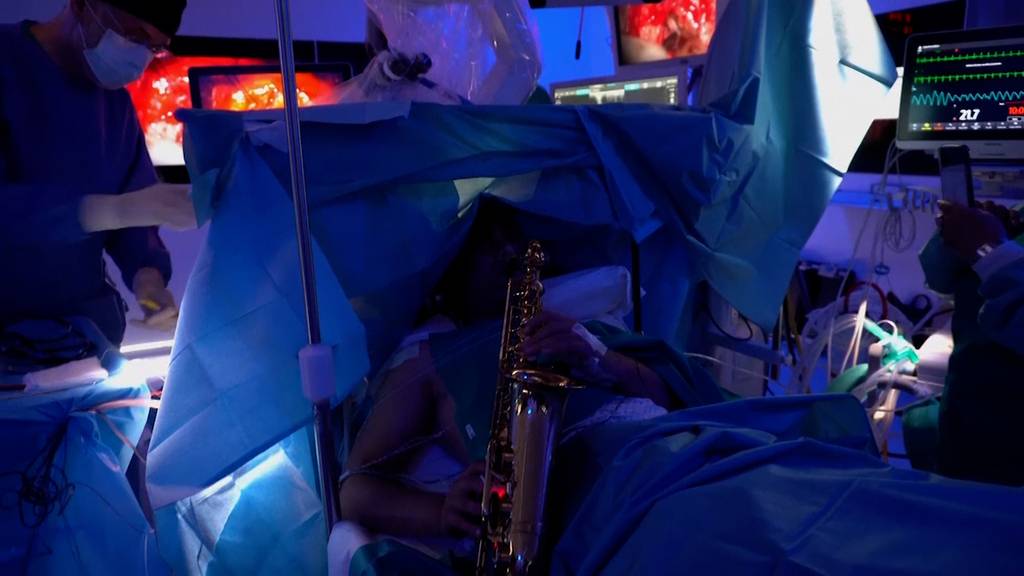 Mann wird Hirntumor entfernt – und er spielt dabei Saxophon