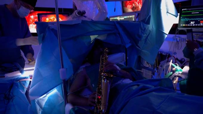 Mann wird Hirntumor entfernt – und er spielt dabei Saxophon