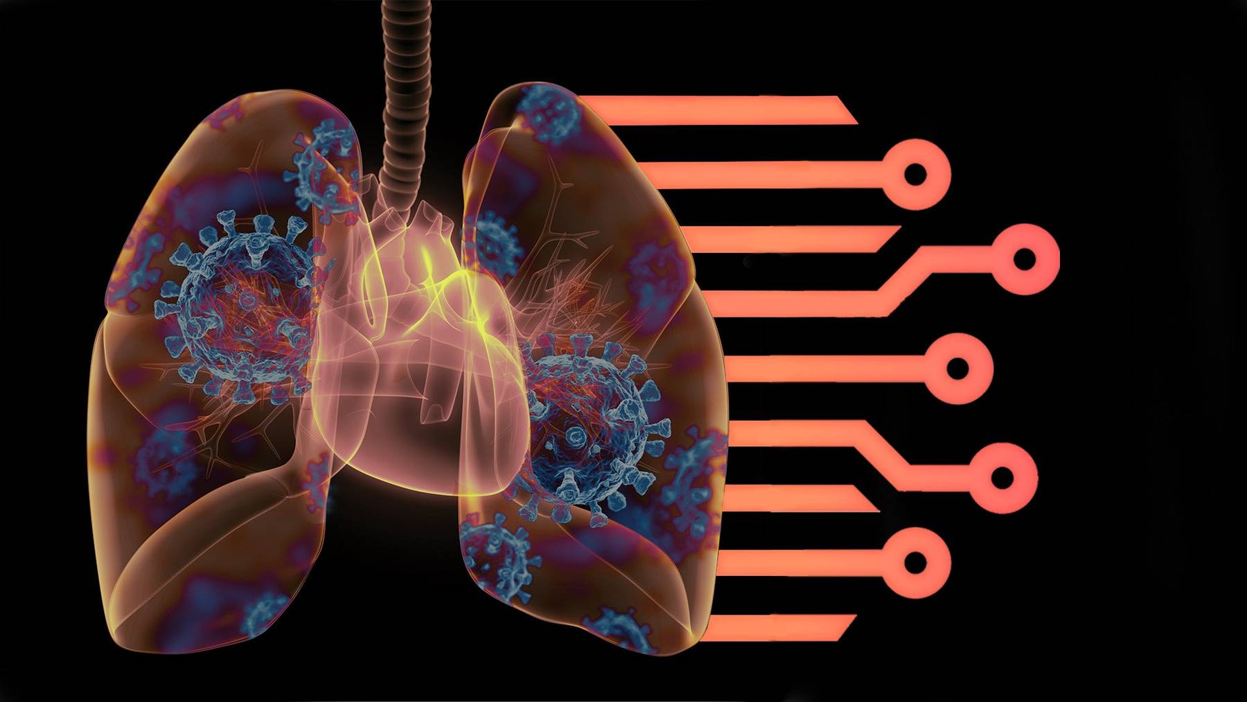 Algorithmen sollen helfen, Covid-19 in Lungenaufnahmen  automatisch zu erkennen.