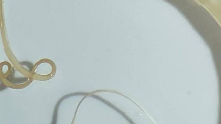 Die neu entdeckte parasitäre Wurmart namens Trichuris incognita befindet sich nun offiziell in der Sammlung des Naturhistorischen Museums Basel.