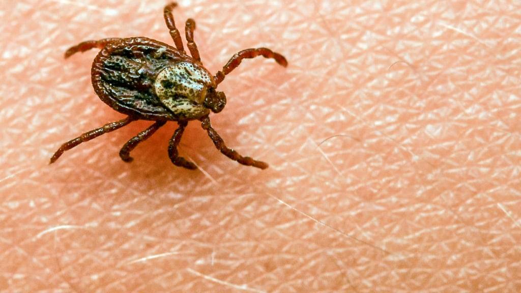 Das durch Zecken übertragene FSME-Virus kann eine Hirnhautentzündung verursachen. (Archivbild)