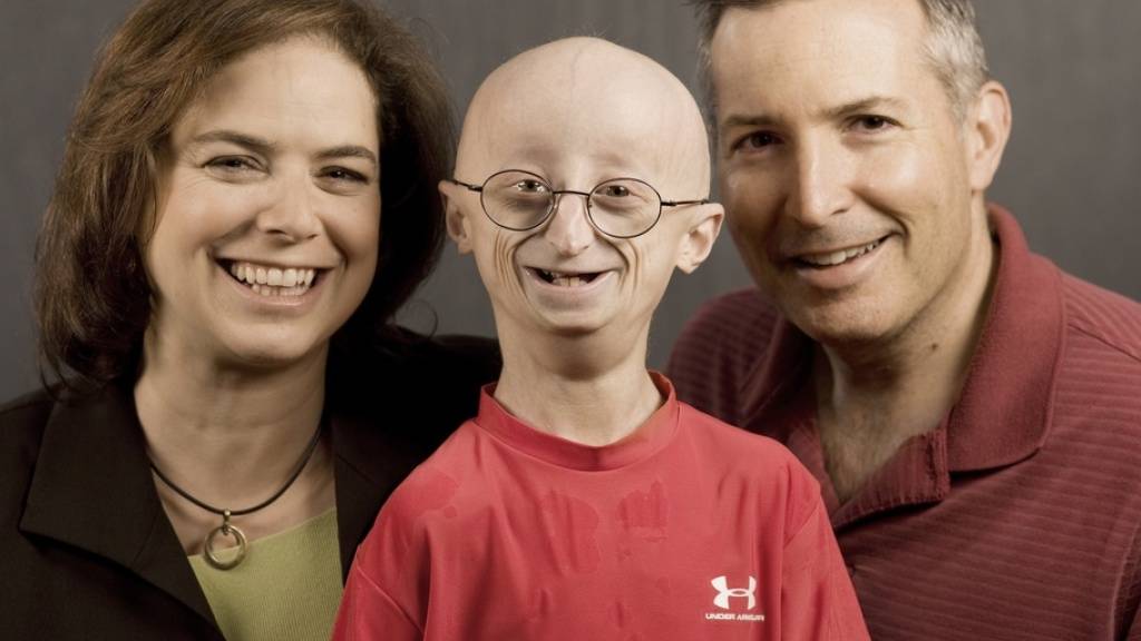Der mit Progeria geborene Sam Berns zusammen mit seinen Eltern Leslie Gordon (l) und Scott Berns (r). Sam starb 2014 mit 17 Jahren. Seine Mutter gründete eine Progeria-Stiftung und ist Mitautorin einer aktuellen Studie, in der ein Heilverfahren erfolgreich an Mäusen getestet wurde. (Archivbild).