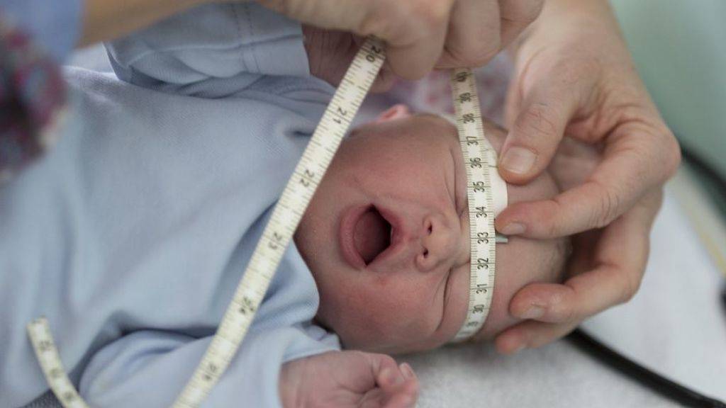 Die durchschnittliche Körpergrösse von Babys bei der Geburt nimmt pro Jahr einen Millimeter zu. Der Geburtskanal der Mutter hinkt dem evolutionär hinterher. Die Folge: mehr Kaiserschnitte. (Symbolbild)