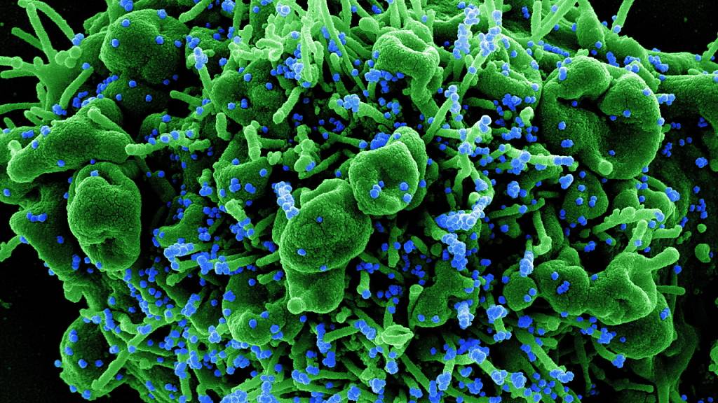 Mikroskopaufnahme einer menschlichen Zelle (grün), die mit Coronavirus-Partikeln (blau) infiziert ist. (Archivbild)
