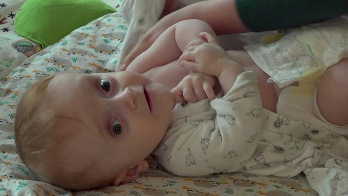 Knochen aus Glas: Dieses Baby ist mit 20 Brüchen zur Welt gekommen