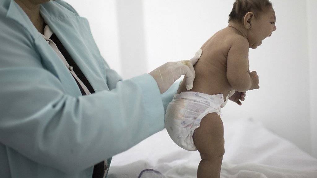 Eine brasilianische Ärztin untersucht ein Baby mit Mikrozephalie. Ob das Zika-Virus verantwortlich ist für die Schädelfehlbildung bei Neugeborenen versuchen Forscher derzeit herauszufinden - allerdings dürften sie erst in vier bis sechs Monaten mehr wissen.