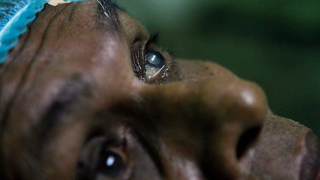 Bei gewissen Krankheiten der Augenhornhaut drängt sich eine Transplantation auf: Patient in einer Klinik der Augenspende-Gesellschaft in Sri Lanka. (Archivbild)