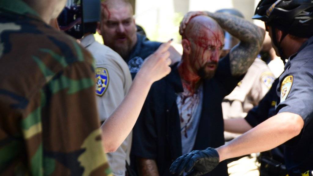 Polizisten begleiten einen Verwundeten nach den Auseinandersetzungen in Sacramento.