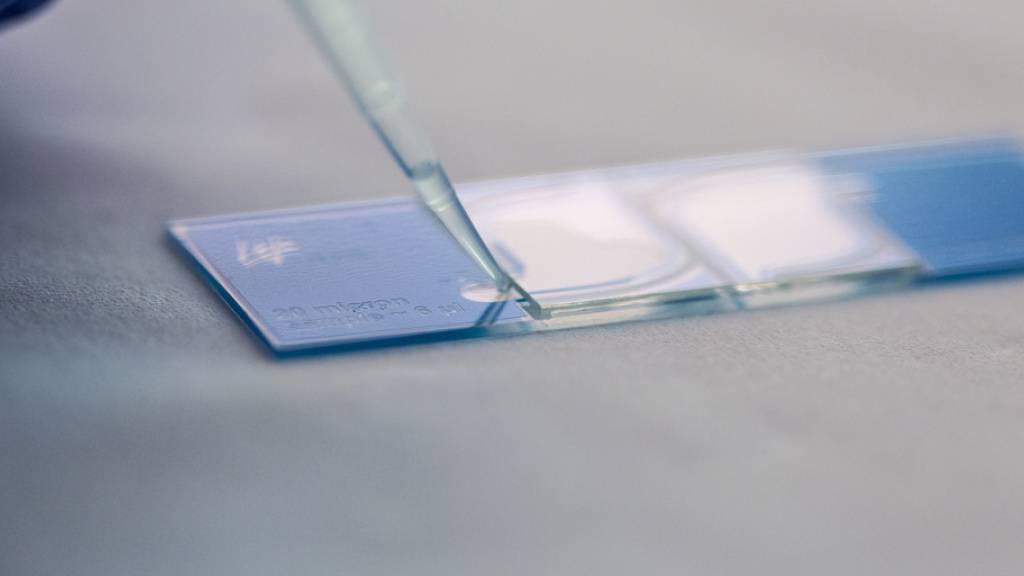 Die Qualität der Spermien wird mit speziellen Methoden unter dem Mikroskop bestimmt. Laut einer neuen Studie könnte die Handynutzung einen negativen Effekt darauf haben. (Archivbild)