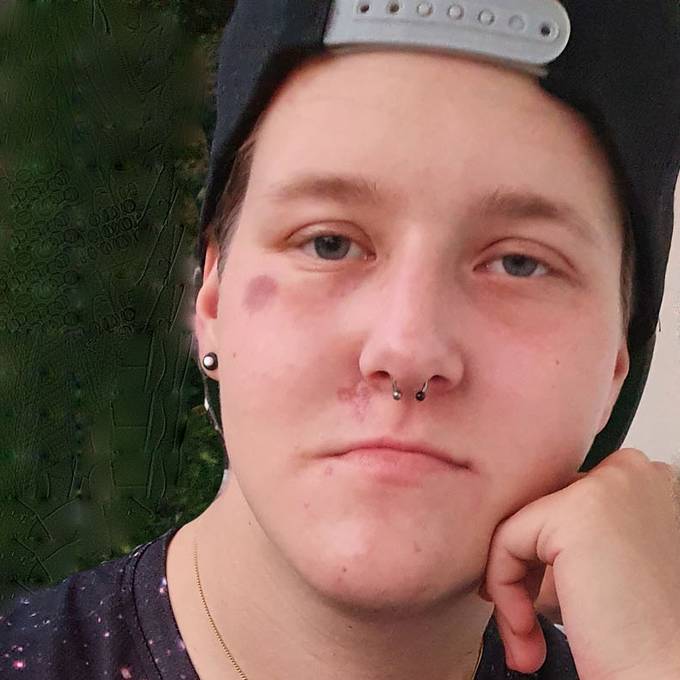 21-Jährige aus Adligenswil wird vermisst