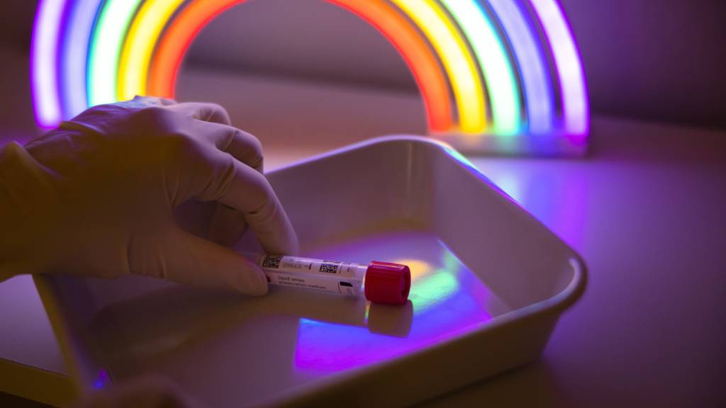 Eine städtische Initiative verlangte Gratistests auf sexuell übertragbare Krankheiten für gewisse Bevölkerungsgruppen der Stadt St. Gallen. (Archivbild)