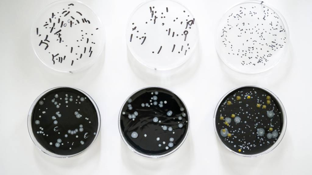 Basel-Stadt zählt zwei neue Erkrankungen aufgrund einer Infektion mit Legionella pneumophila. Eine Person wurde hospitalisiert, eine konnte die Intensivstation verlassen. (Archivbild)