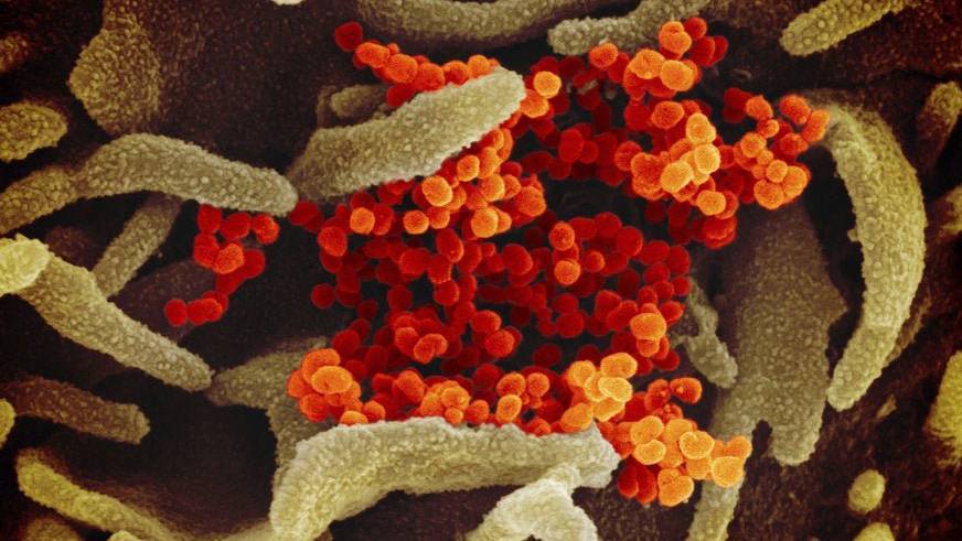 Bild Virus