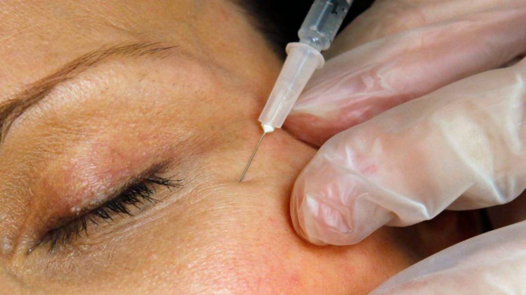 Das Spritzen von Botox ist nicht mehr nur Frauensache. (Symbolbild)