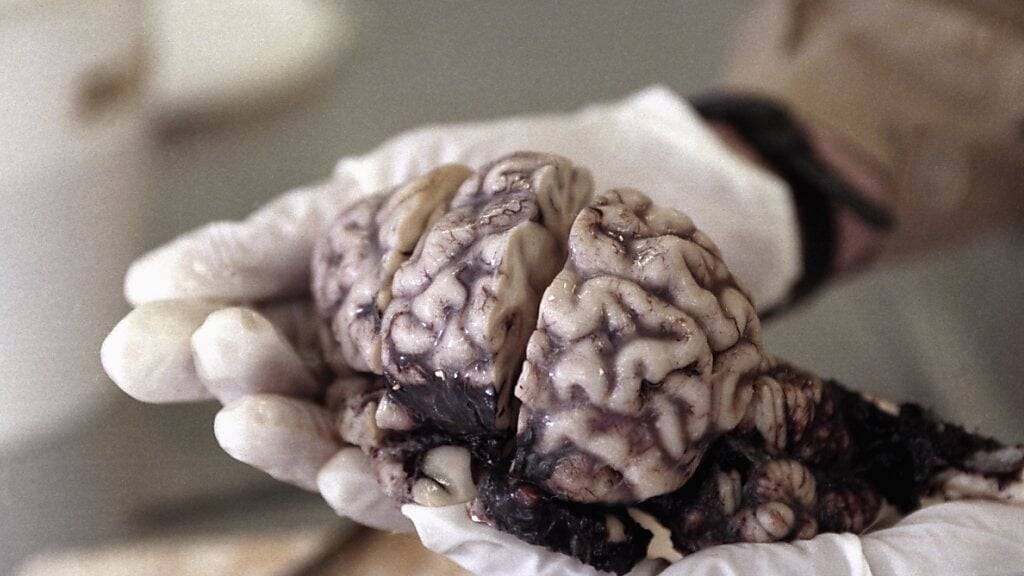 Forscher blicken mit neuer KI-Technik live in Abläufe im Gehirn. (Symbolbild)