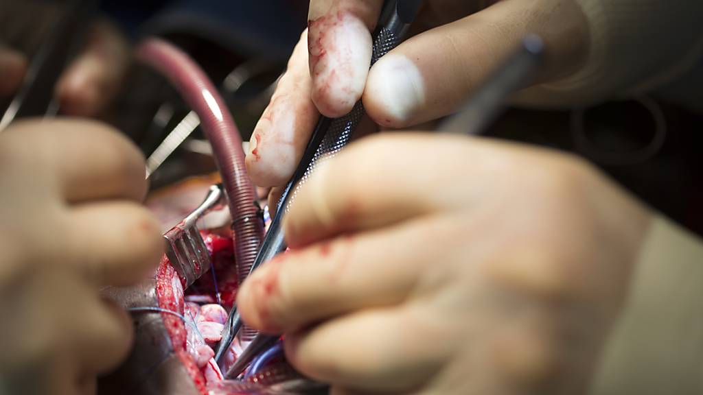 Das Universitätsspital Zürich greift zu Sofortmassnahen: Der Direktor der Herzchirurgie wird für drei Wochen beurlaubt. (Symbolbild)