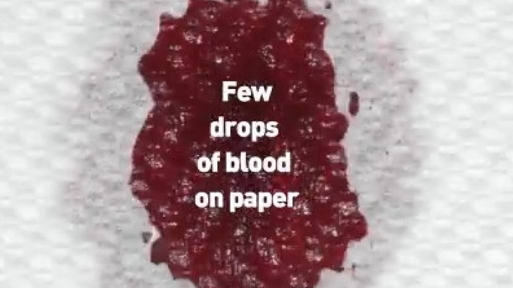 Screenshot aus dem Twitter-Werbefilm der  Welt-Anti-Doping-Agentur (Wada) über ihr erleichtertes  Blutanalyseverfahren DBS (Wada)