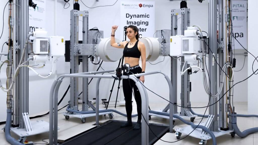 Für die dynamischen 3D-Bilder der Schulter kommt ein Röntgenverfahren am Schweizer Institut für translationale und unternehmerische Medizin in Bern zum Einsatz.