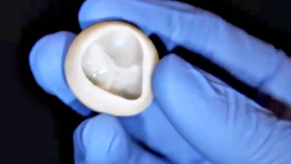 Silikon-Herzklappen aus dem 3D-Drucker hat vor ein paar Tagen die ETH Zürich präsentiert. Nun legen US-Forscher nach: Sie haben aus dem 3D-Drucker funktionierende Herzklappen aus biologischem Material, nämlich Kollagen, hergestellt. (Handout)