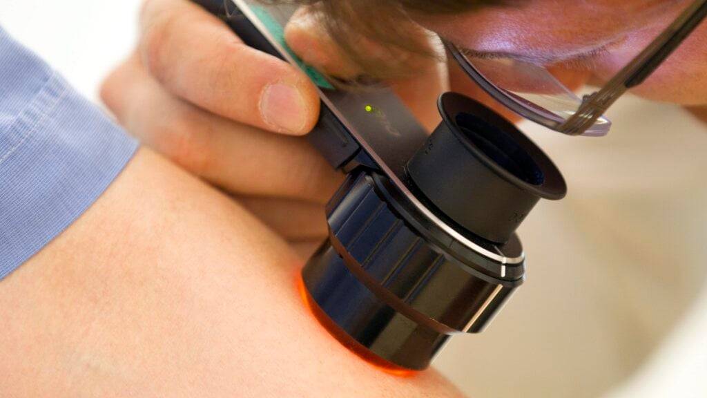 Ein Arzt untersucht einen Mann auf Hautkrebs. (Symbolbild)