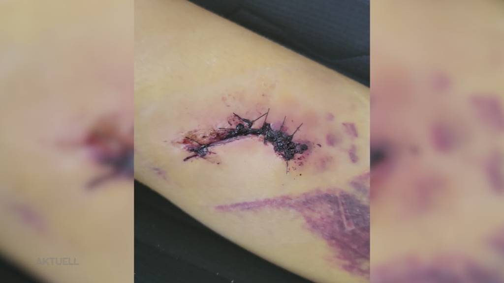 Zu junge Töfffahrer: Nach Unfall der Tochter fordert SVP-Grossrätin Heggli-Boder höhere Alterslimite