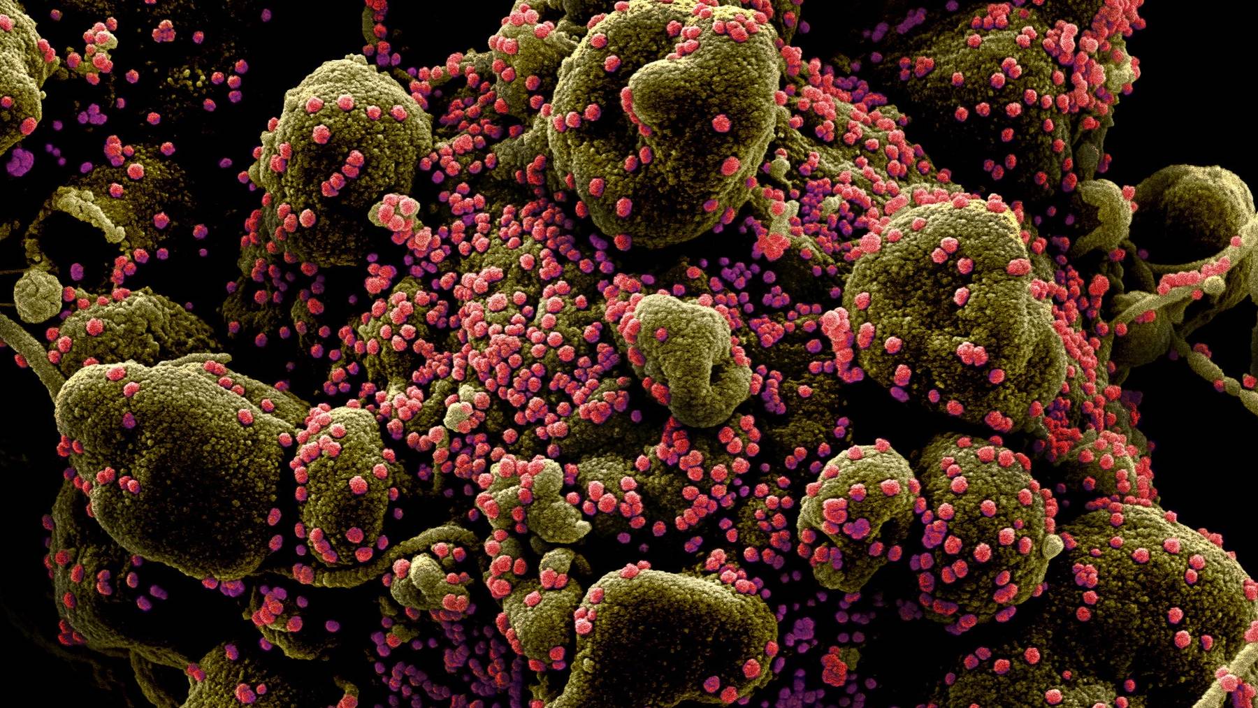 Erste jede 25. Person hat sich in der Schweiz mit dem Coronavirus angesteckt. (Symbolbild)