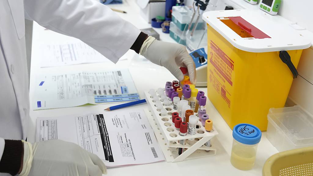HIV ist der Erreger, der die Krankheit Aids auslöst. (Archivbild)