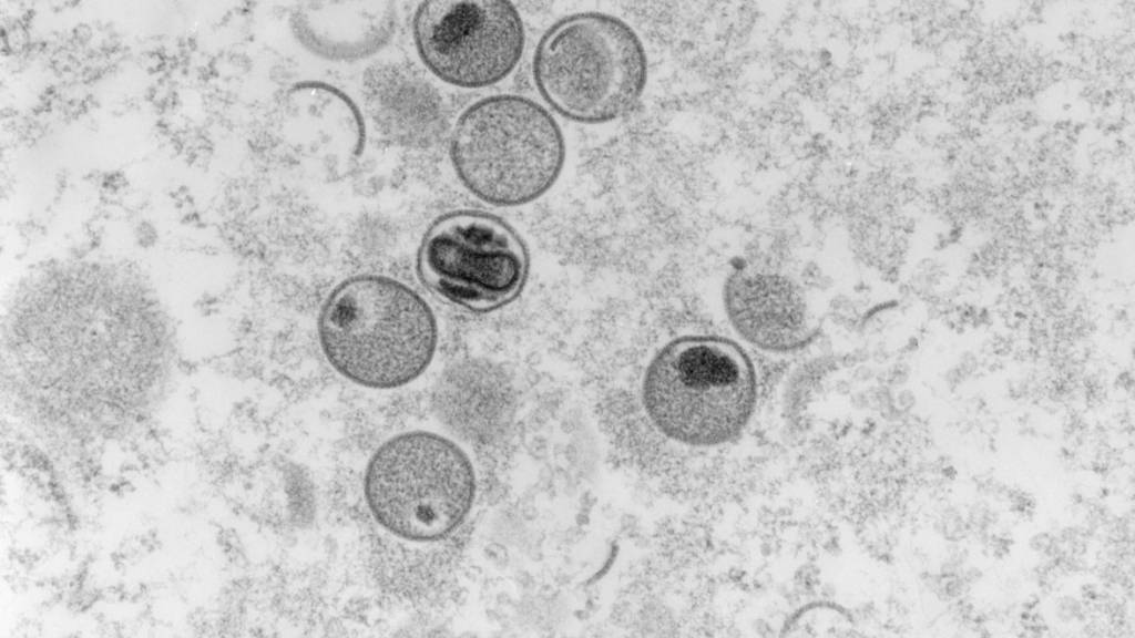 Für das Affenpocken-Virus wurde noch keinen neuen Namen gefunden, die Krankheit heisst laut WHO neuerdings Mpox. (Archivbild)