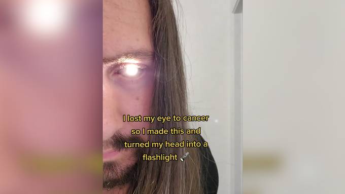 Mann begeistert mit leuchtender Augenprothese