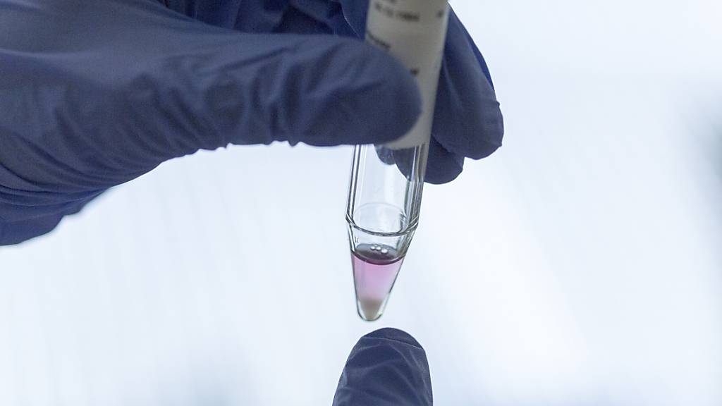 Handystrahlung ist nicht zwangsläufig der Grund für die tiefe Spermienqualität bei Männern - und auch kein zwingender Indikator für die Fruchtbarkeit. Männer sollten sich keine Sorgen machen, so die Biologin Rita Rahban von der Universität Genf. (Symbolbild)