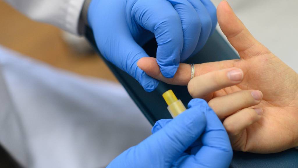 Blutentnahme für einen HIV-Test in einem Labor. (Symbolbild)