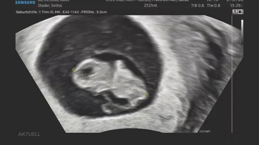 Schwangerschaft: Hat das Vergewaltigungsopfer mit dem tragischen Fall endgültig abschliessen können?